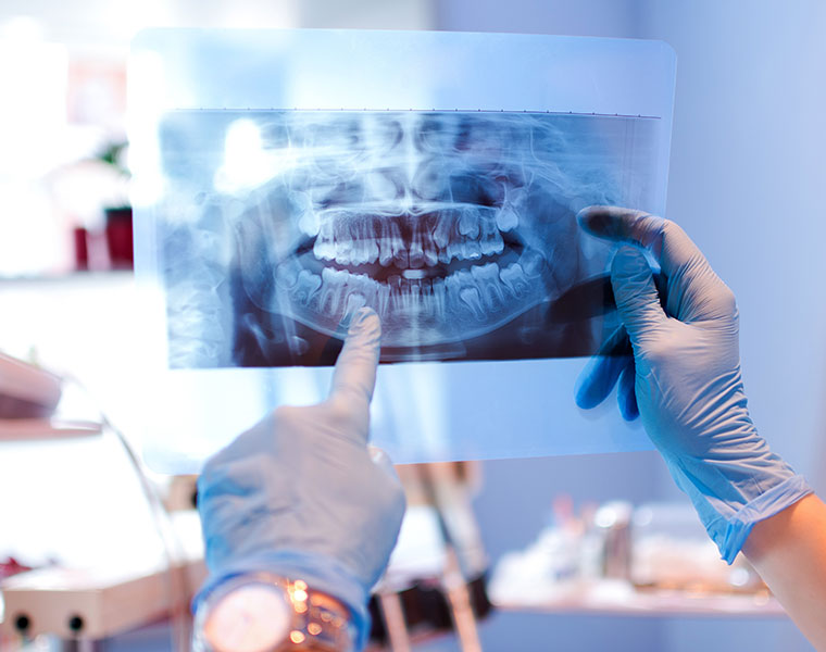 Zahn-OP´s, Leistung der Zahnarztpraxis Peter La Rue in Aldersbach